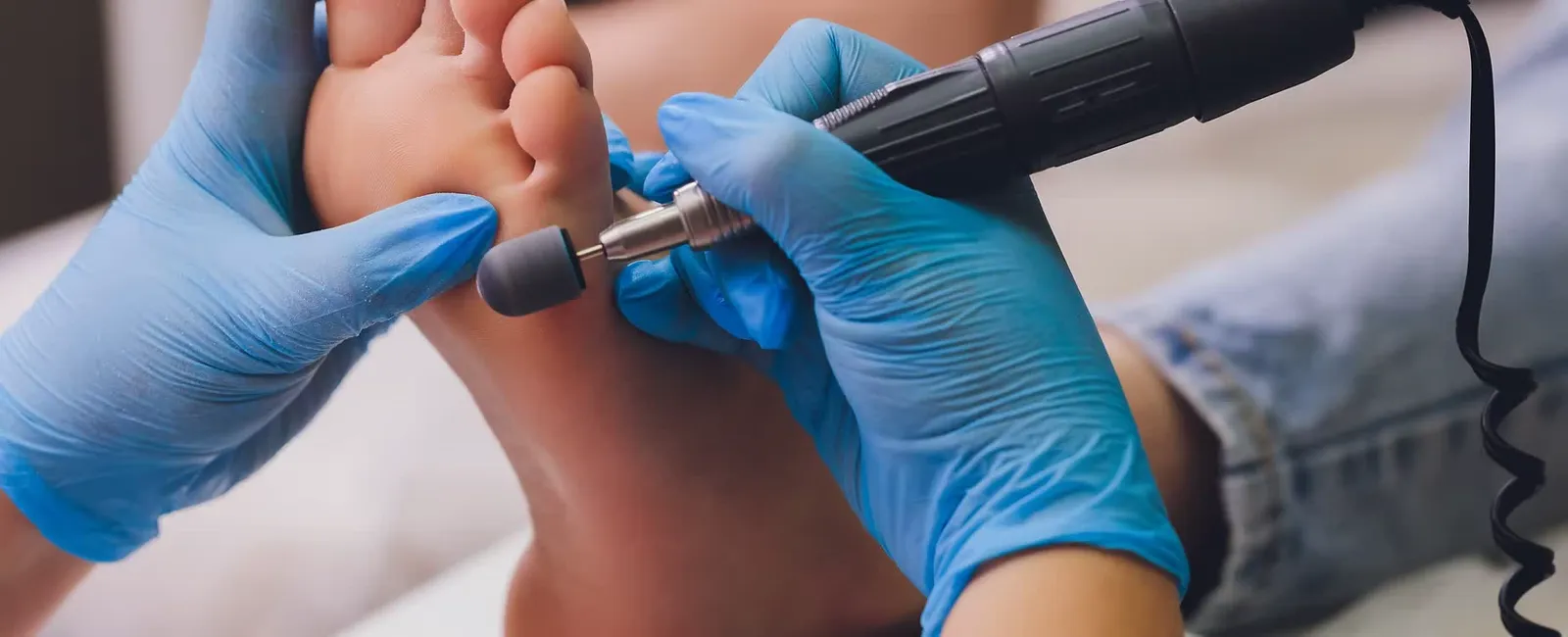 A podiatrist in gloves treating a patient's foot with a nail drill.